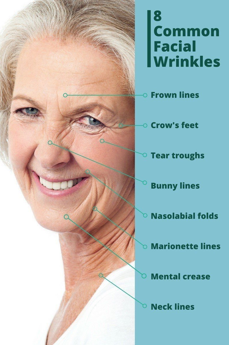 8-common-facial-wrinkles1-e1489632765542.jpg